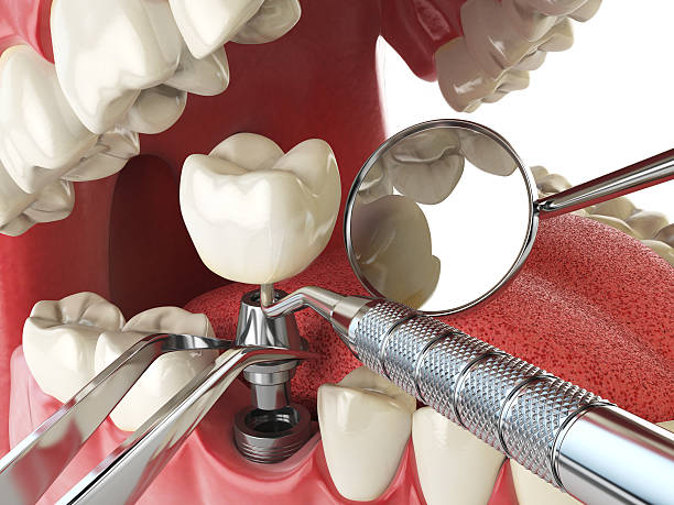 Best Emergency Broken Tooth Repair in Blackwater, AZ
